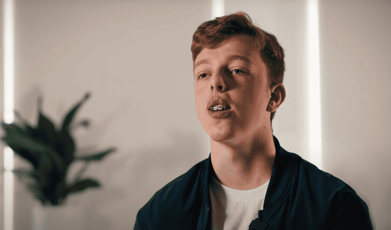 Introducing Harry. An 18-year-old born with a bilateral cleft lip