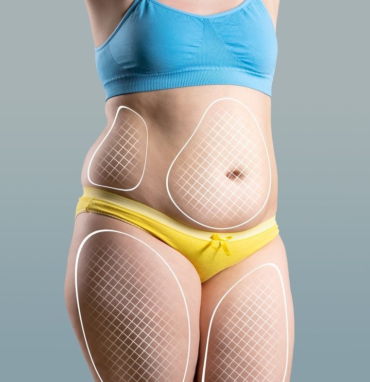 body sculpting london