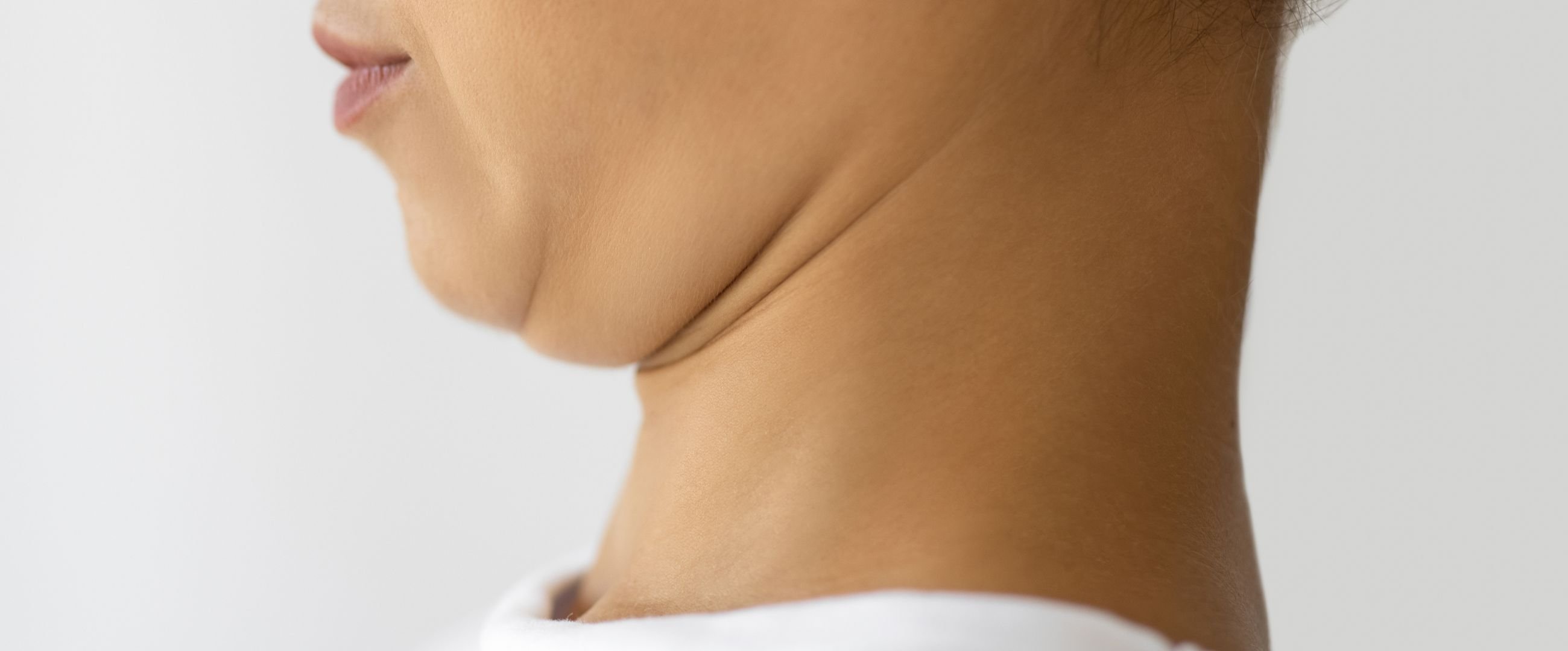 woman with double chin