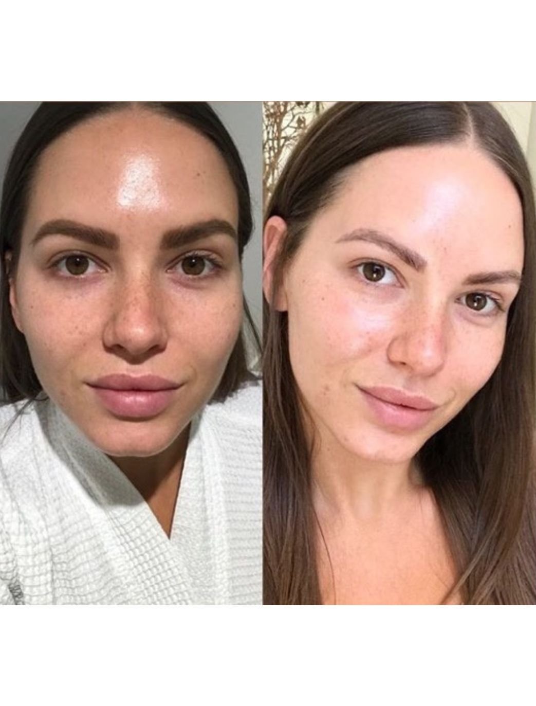 influencers facial in london