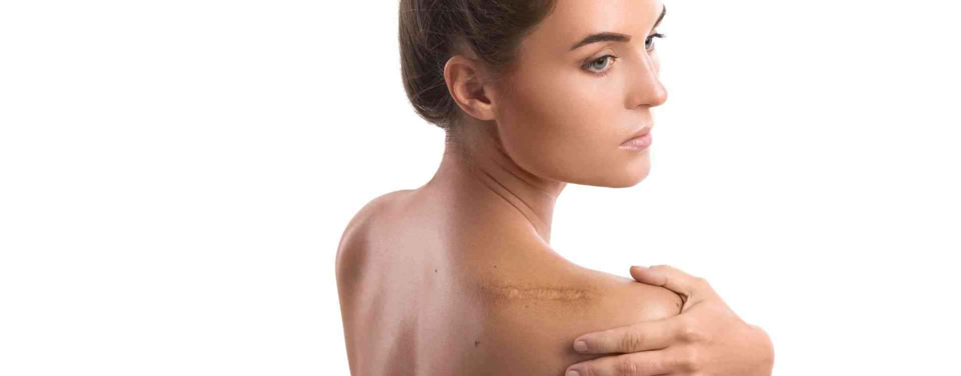 scarring treatment in london clinic harley street