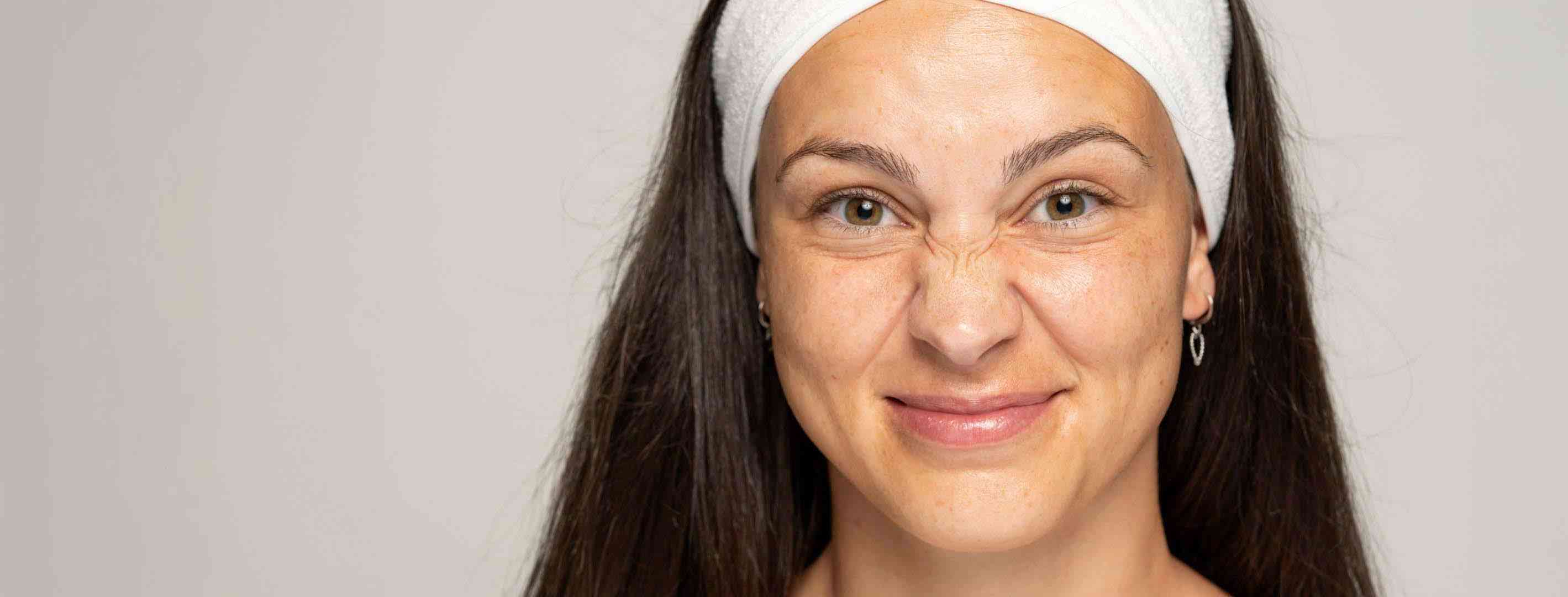 Bunny lines condition treatment london clinic