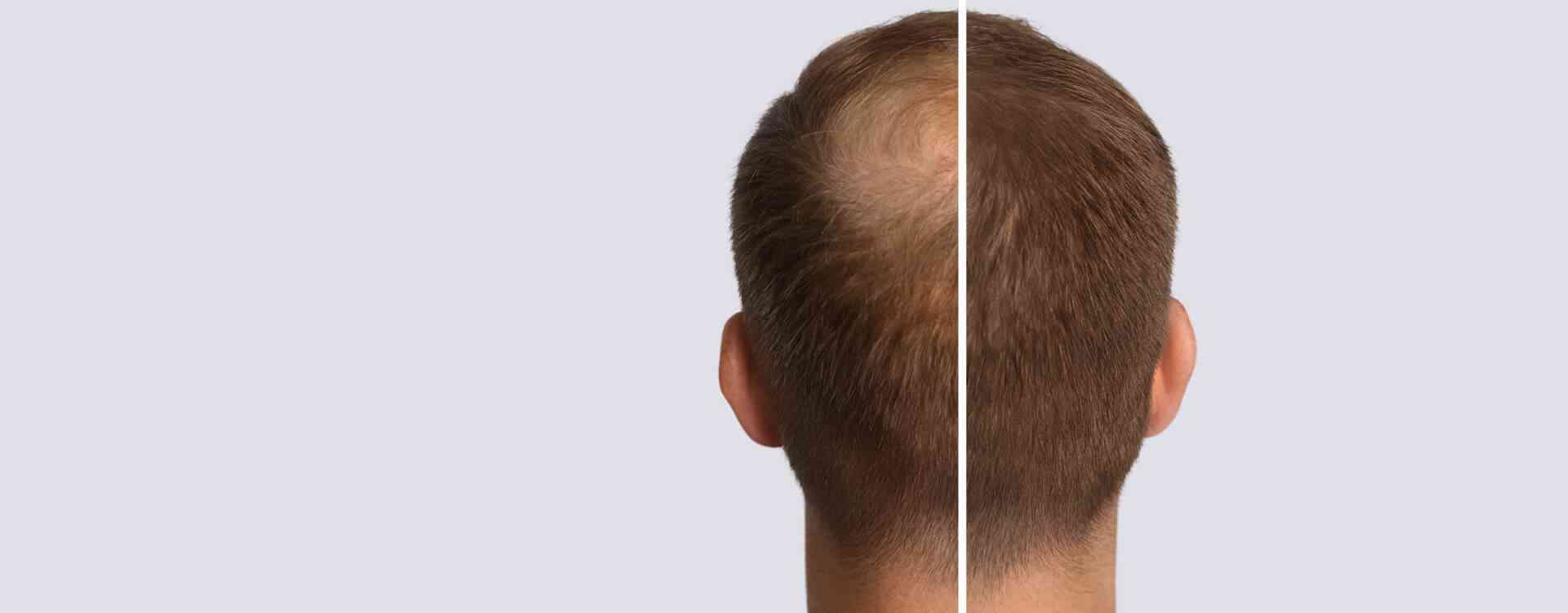 Calecim hair and skincare treatment london