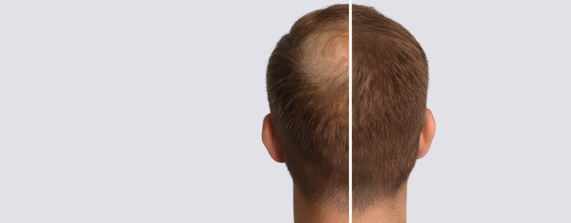 Calecim hair and skincare treatment london