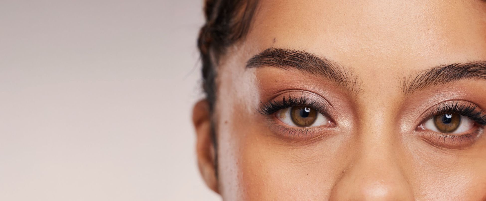 Woman after brow lift close up