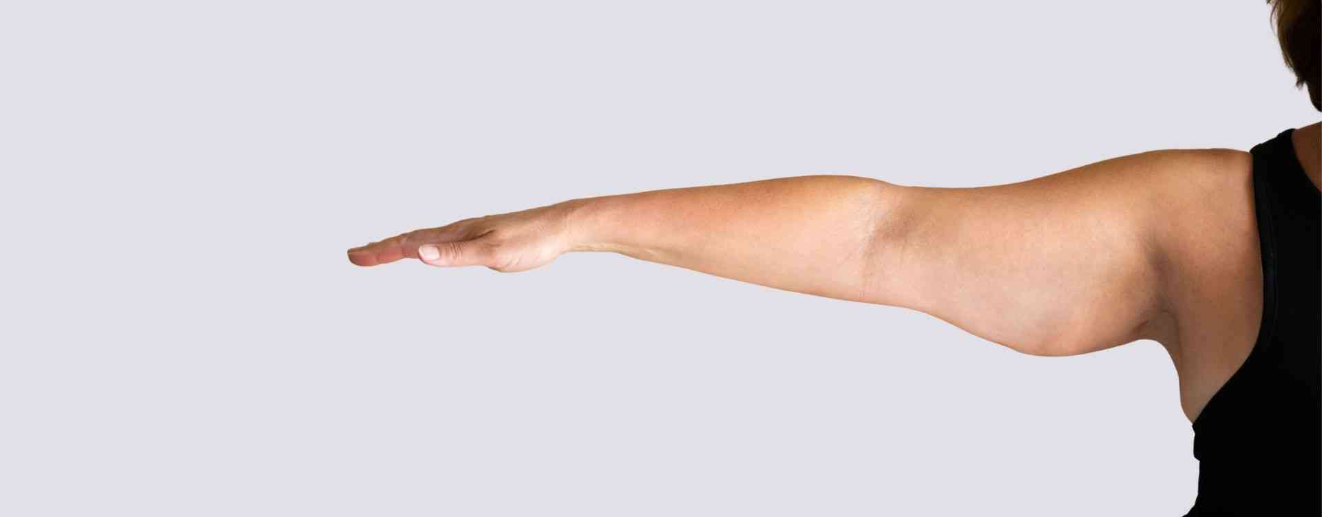 bingo wings arm fat treatment in london