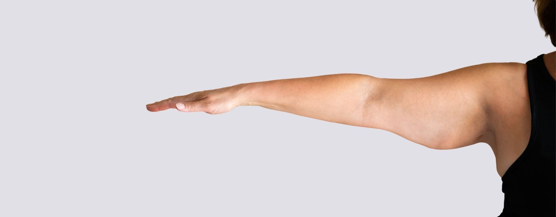 bingo wings arm fat treatment in london