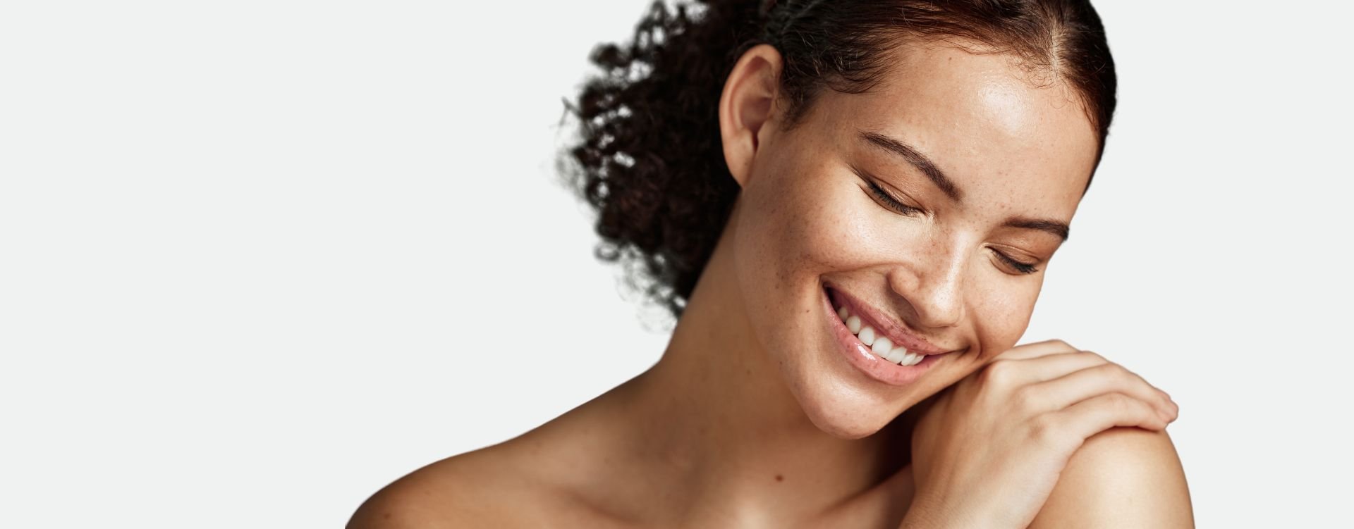 excel V+ rosacea pigmentation treatment in london