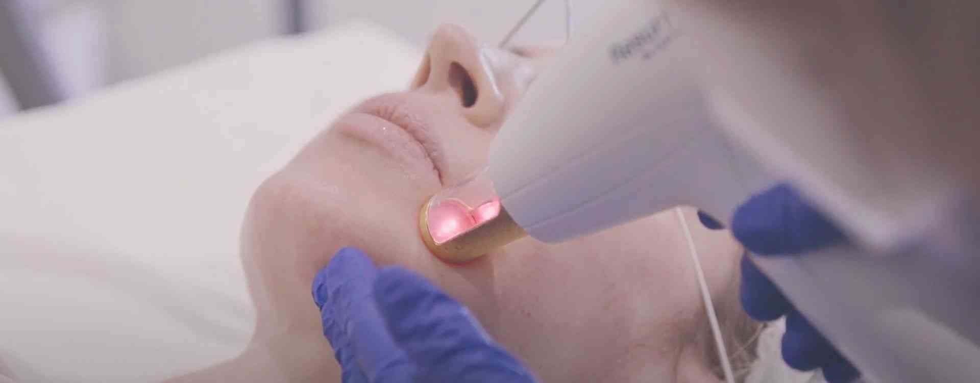 m22 skin rejuvenation london