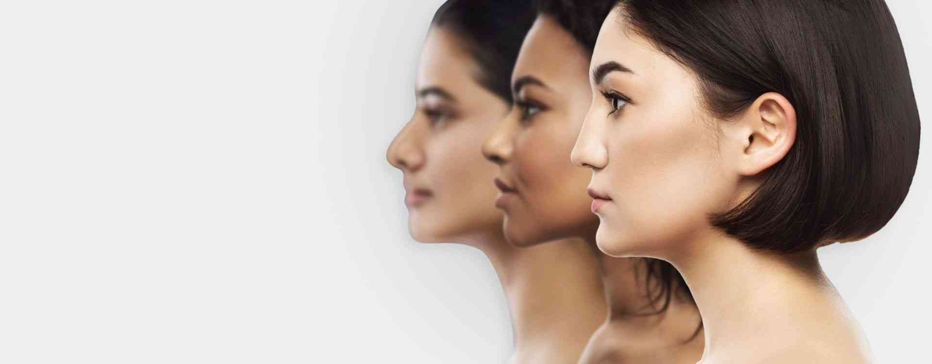 non surgical nose job london