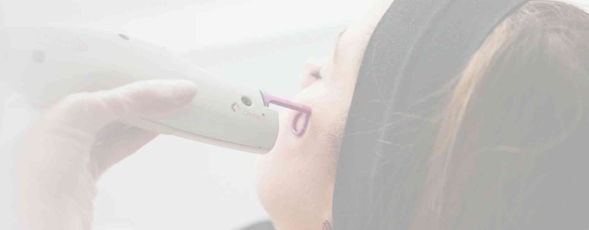 pulse dye laser face redness treatment london clinic