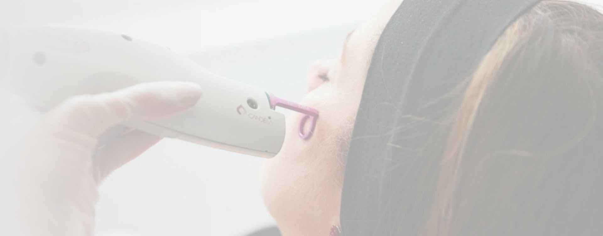 pulse dye laser face redness treatment london clinic