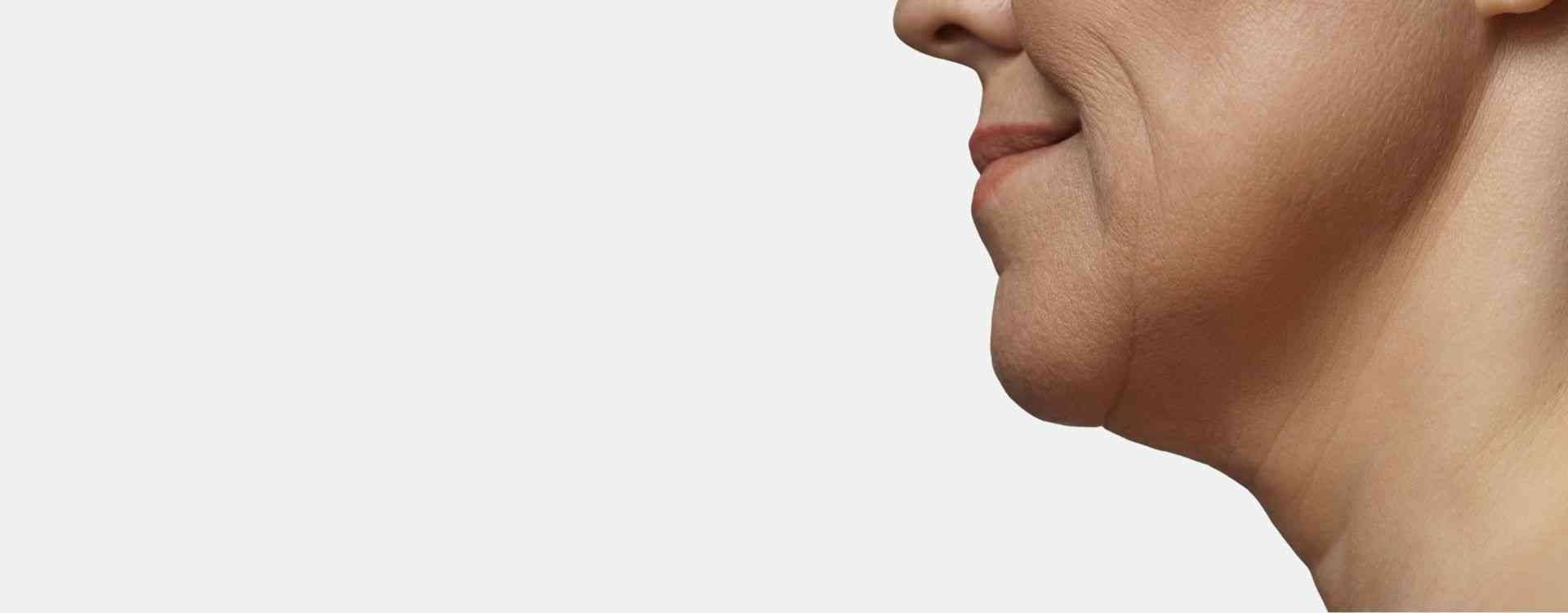 weak chin treatment london clinic