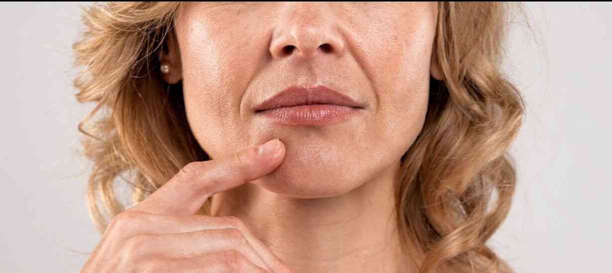 woman with deep nasolabial folds.jpg