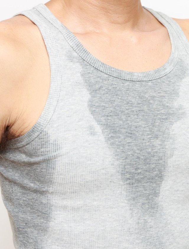 Excessive Sweating: Causes and Treatment | PHI Clinic London